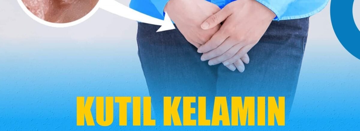 Kutil Kelamin Klinik Newton